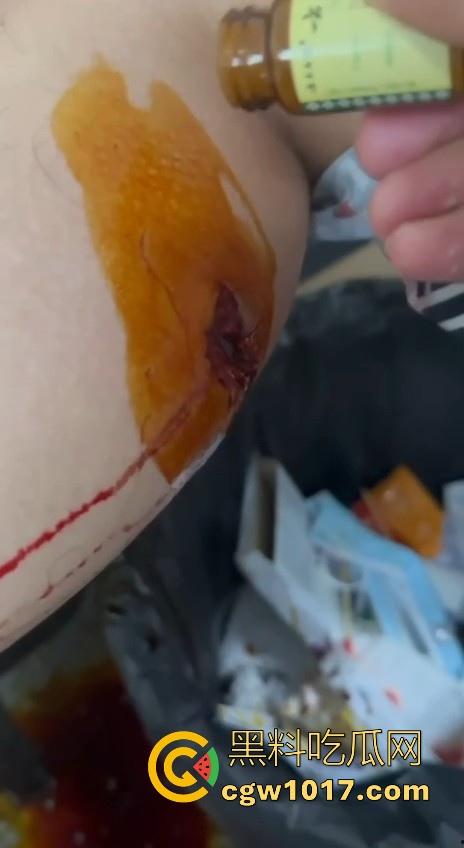 妙瓦底顺达园区缅甸KUN武装屠杀中国人！抢劫、轮奸、枪杀地盘之争，诈骗人员沦落为牺牲品，这时候你是中国人啦！-9