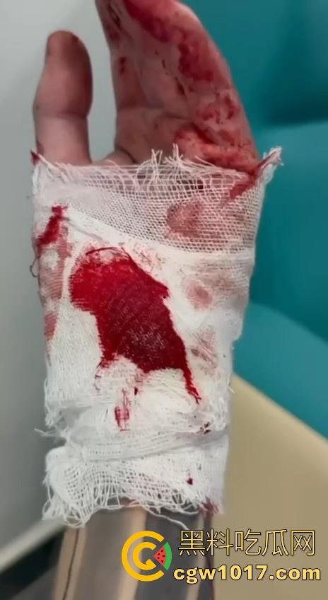 妙瓦底顺达园区缅甸KUN武装屠杀中国人！抢劫、轮奸、枪杀地盘之争，诈骗人员沦落为牺牲品，这时候你是中国人啦！-14