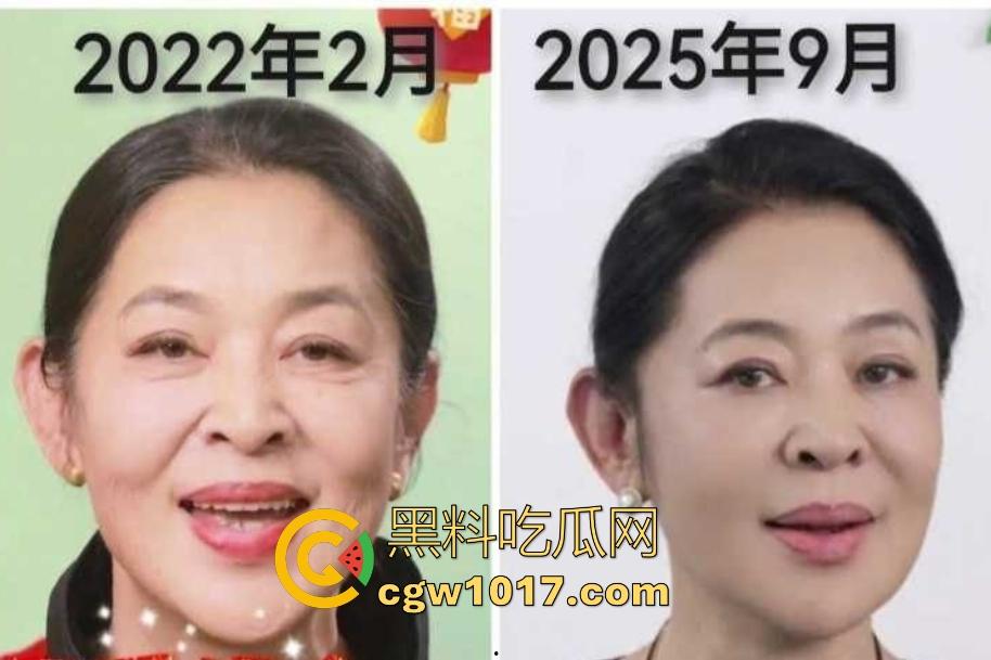 你见过心脏移植的明星吗？【李连杰】等众多大咖器官移植，换心换血黑科技年轻20岁，难道真有这种永生秘方？-4